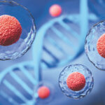 Therapies for Alzheimer