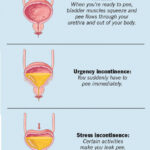 Urinary Incontinence