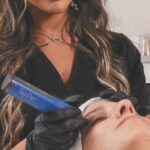 SkinPen Microneedling