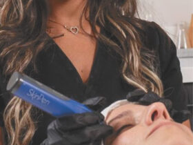 SkinPen Microneedling