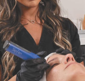 SkinPen Microneedling