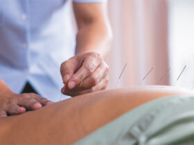 Acupuncture