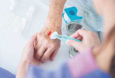 Mobile Wound Care