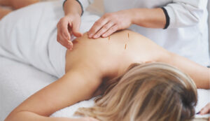 Natural Healing for PCOS