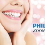 Whitening Tips