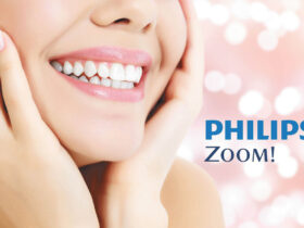 Whitening Tips