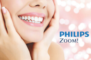 Whitening Tips