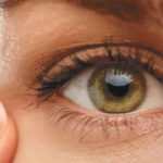 Meibomian Gland Dysfunction