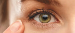 Meibomian Gland Dysfunction