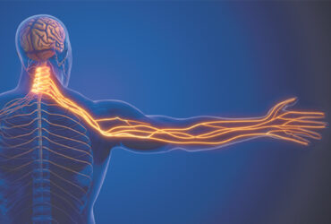 Cervical Disk Replacement