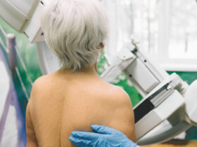 Breast Cancer Screening