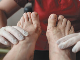 Diabetic Foot Ulcers