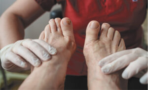 Diabetic Foot Ulcers 