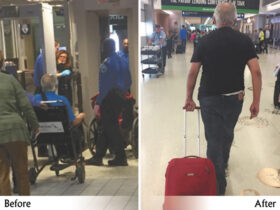 Parkinson’s Disease