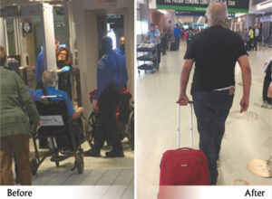 Parkinson’s Disease