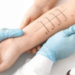 Allergy Testing and Treatment