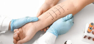 Allergy Testing and Treatment
