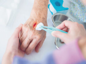 Mobile Wound Treatment