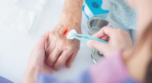 Mobile Wound Treatment