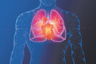 Inflammatory Lung Conditions