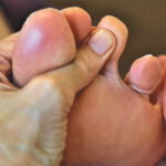 Big Toe Arthritis