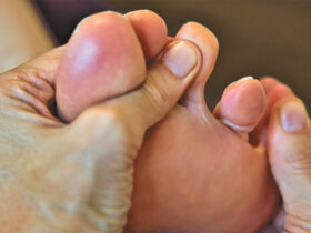Big Toe Arthritis