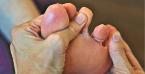 Big Toe Arthritis