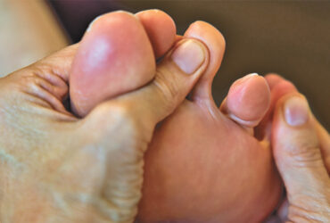 Big Toe Arthritis