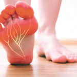 Relief From Nerve Pain