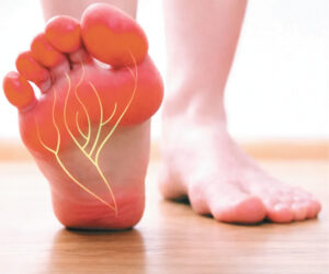 Relief From Nerve Pain