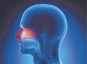 Sinusitis 