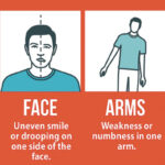 Stroke Awareness