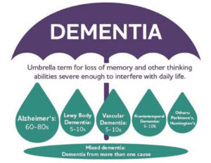 memory matters