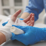 Hand Injury