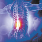 Back or Hip Pain?