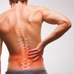 Chronic Low-Back Pain