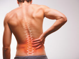 Chronic Low-Back Pain