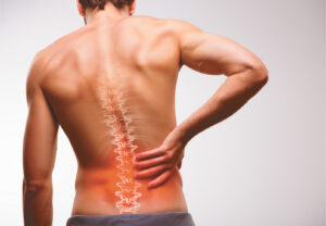 Chronic Low-Back Pain