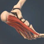 Orthotics Restructure