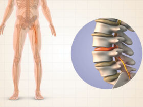 Pain Cycle