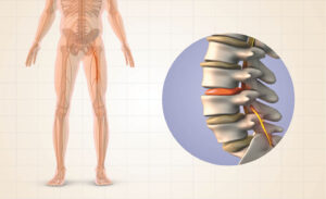 Pain Cycle