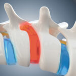 Revolutionizing Pain Relief
