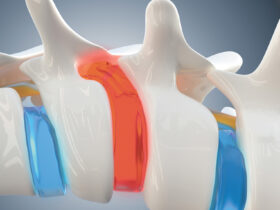 Revolutionizing Pain Relief