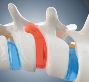 Revolutionizing Pain Relief