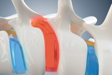 Revolutionizing Pain Relief