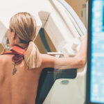 Breast Cancer and Reconstruction