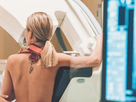 Breast Cancer and Reconstruction